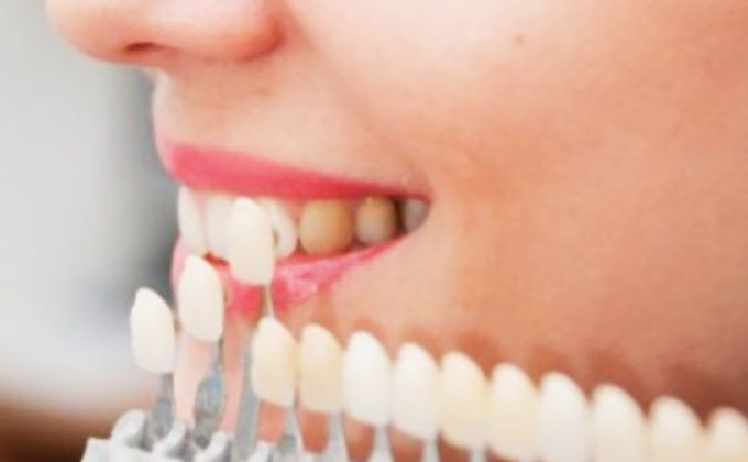 Odontologia Estética