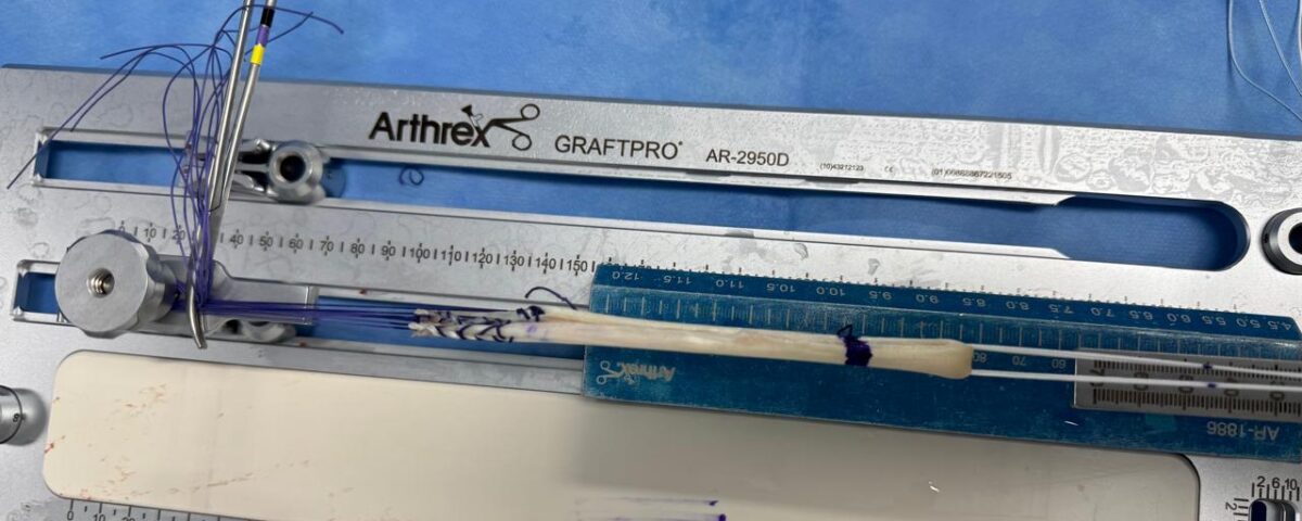 qual o tempo de recuperação de uma cirurgia de lca