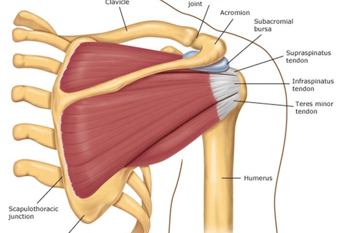 Cirurgia para manguito rotador