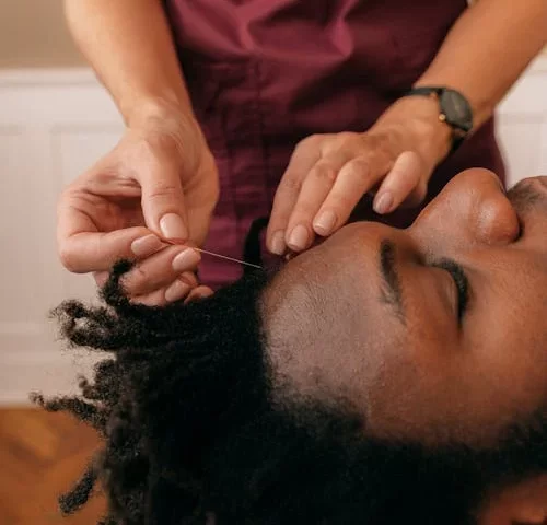 Acupuntura para Ansiedade em Guarulhos