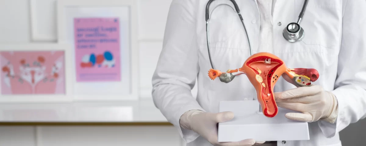 Especialistas em Síndrome Do Ovário Policístico