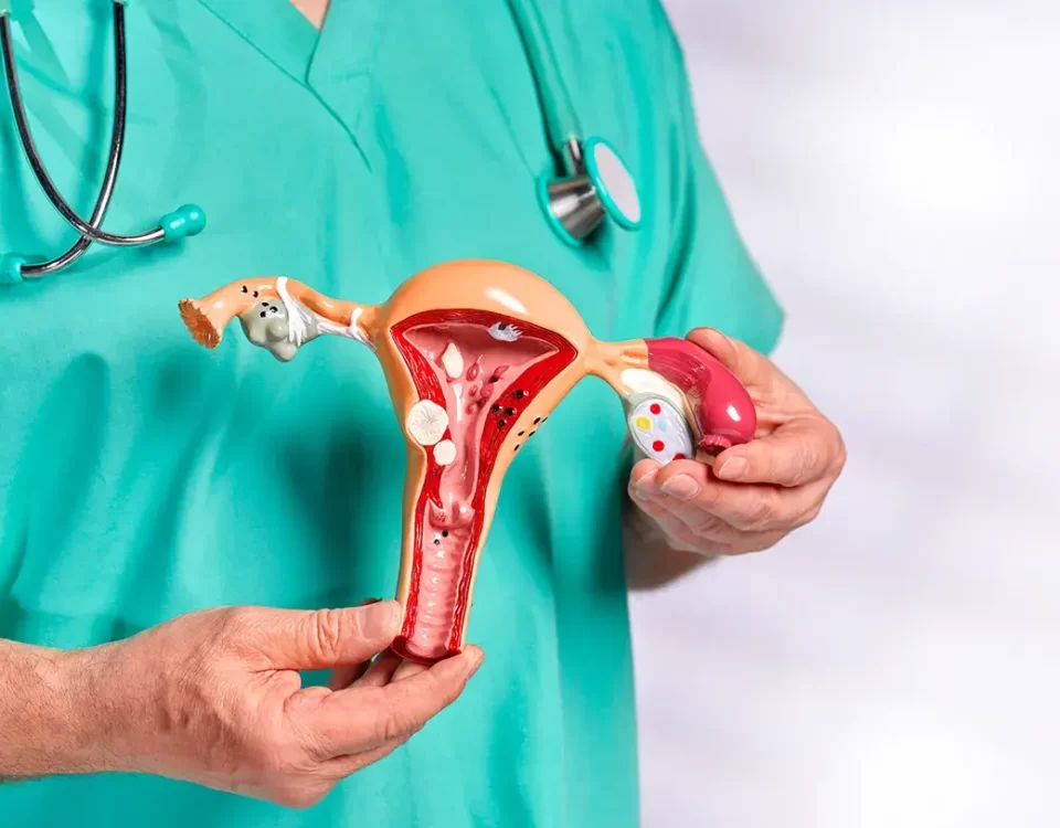 Ginecologista Especialista em Endometriose