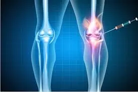 Médico especialista em infiltração nos joelhos