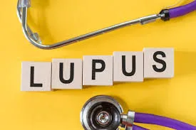 Médico especialista em tratamento de lupus