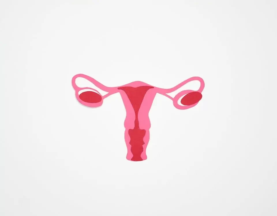 Policisto No Ovário Tem Cura