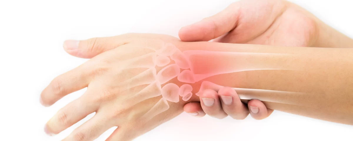 Tratamento para Reumatismo