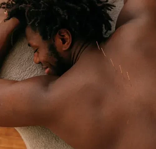 Acupuntura em Guarulhos