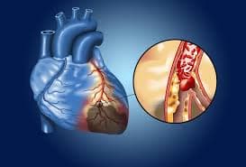 Médica Especialista em Doença Arterial Coronária