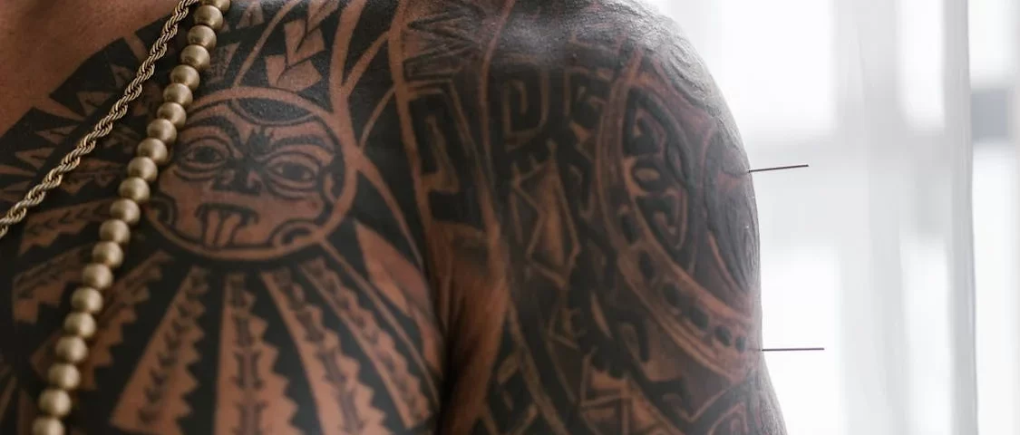 Tratamentos com Acupuntura em Guarulhos