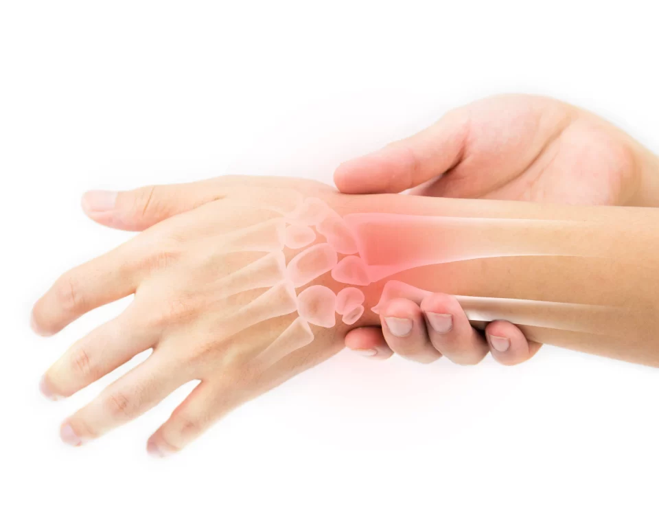 Tratamento para Reumatismo