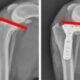 Ruptura de Ligamento em Cães